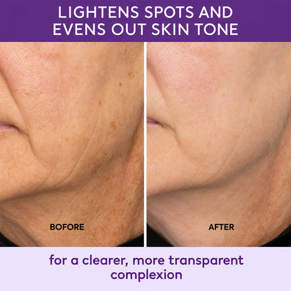Highly effective whitening and spot-lightening cream