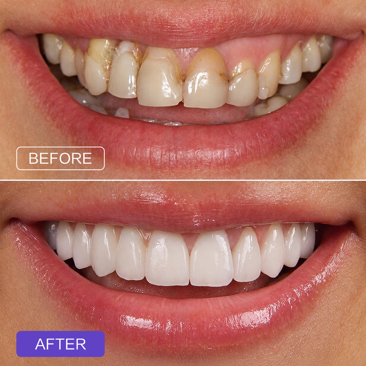 Purple Toothpaste Tablets-Fluoride-free oral care