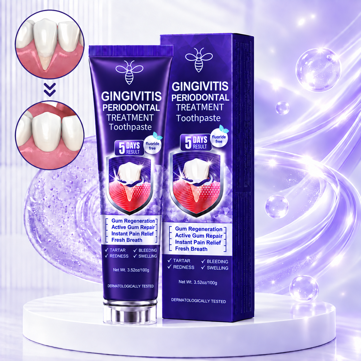Gingivitis Periodontal Treatment Toothpaste