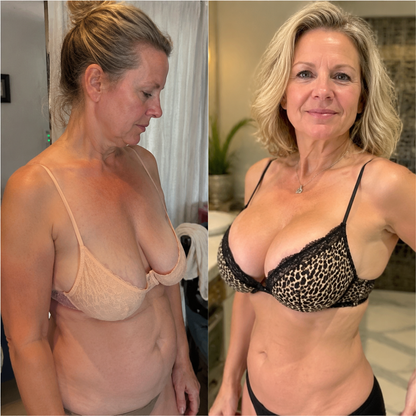 Targeted Breast Enhancement Advanced Nano Microneedle Patch