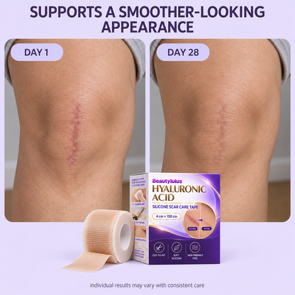 Nano Microneedle Scar Care Tape – Targeted Hyaluronic Acid Care for Visible Scars