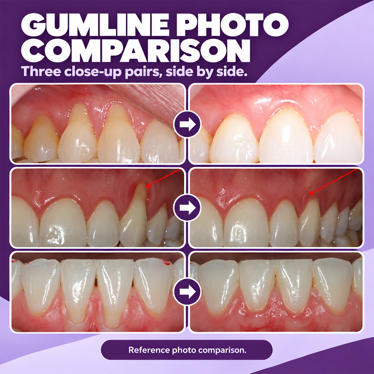 Marine Collagen for Gums — Supports Healthy Gingival Tissue