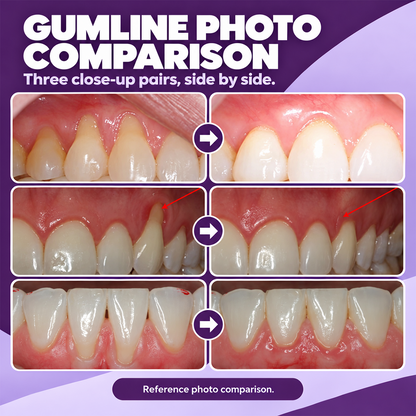 Marine Collagen for Gums — Supports Healthy Gingival Tissue