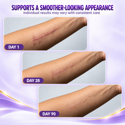 Nano Microneedle Scar Care Tape – Targeted Hyaluronic Acid Care for Visible Scars