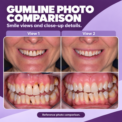Marine Collagen for Gums — Supports Healthy Gingival Tissue