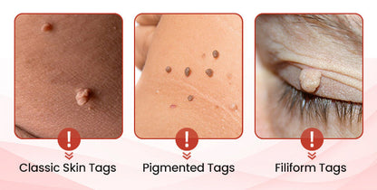 💥painless micro-patch🔥