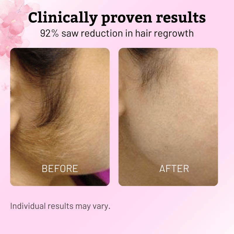 ✨ Caramela Beauty Cyperus Rotundus Oil for Natural Permanent Hair Reduction