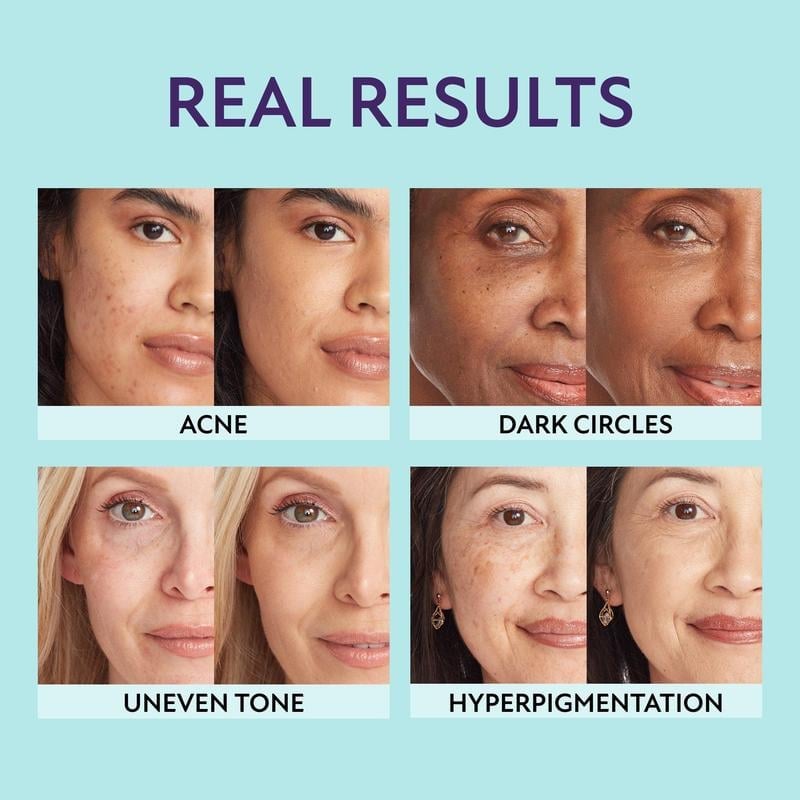 All-in-one moisturizer, concealer & coverage
