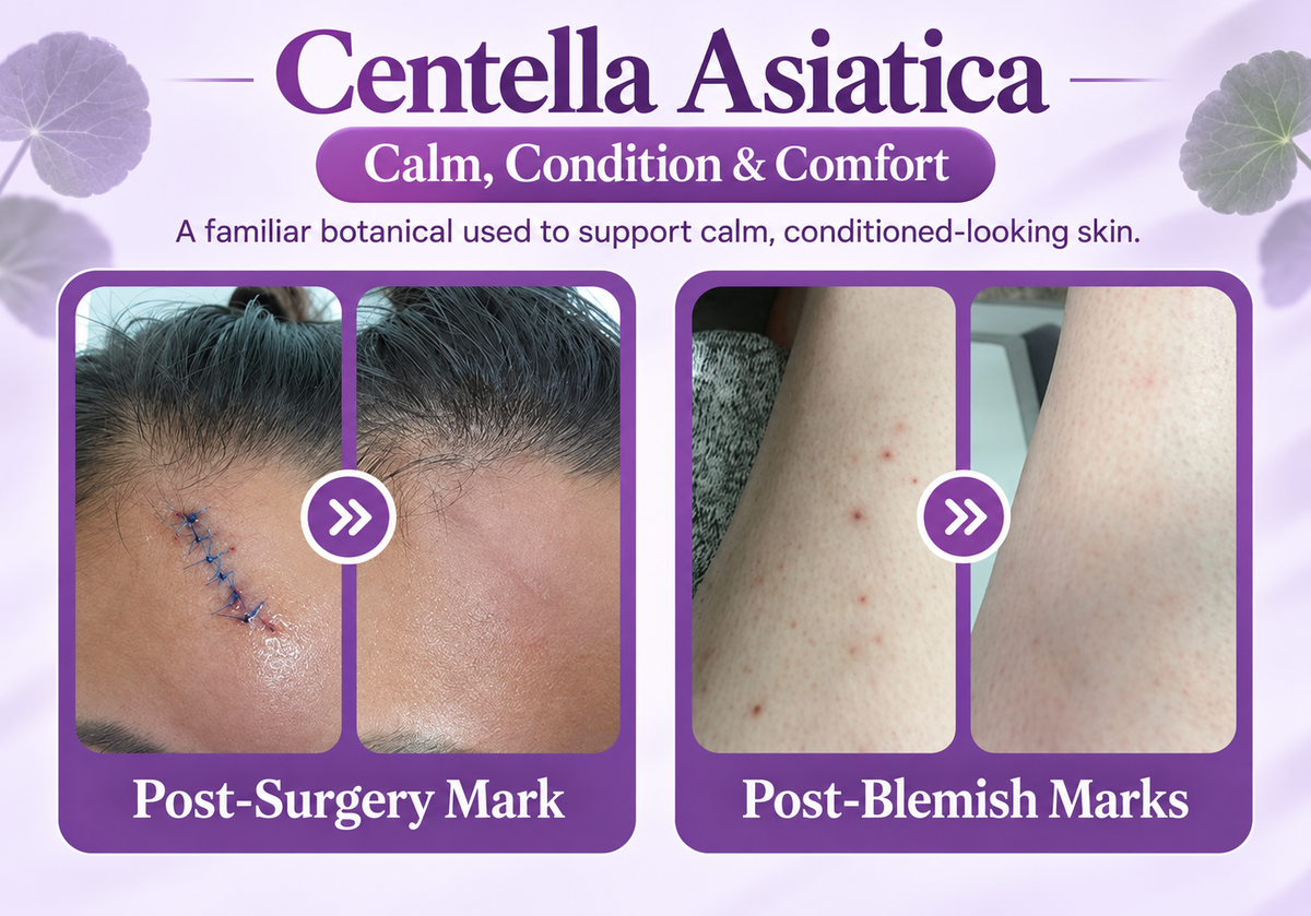 Nano Microneedle Scar Care Tape – Targeted Hyaluronic Acid Care for Visible Scars
