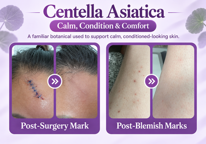 Nano Microneedle Scar Care Tape – Targeted Hyaluronic Acid Care for Visible Scars