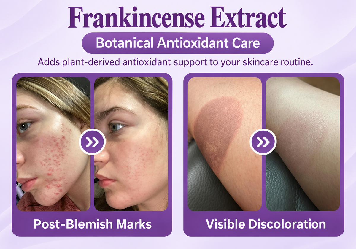 Nano Microneedle Scar Care Tape – Targeted Hyaluronic Acid Care for Visible Scars