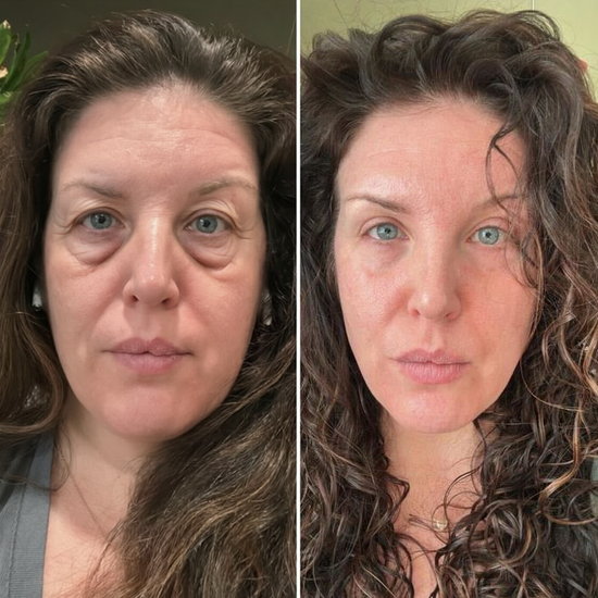 Customer before and after skincare results