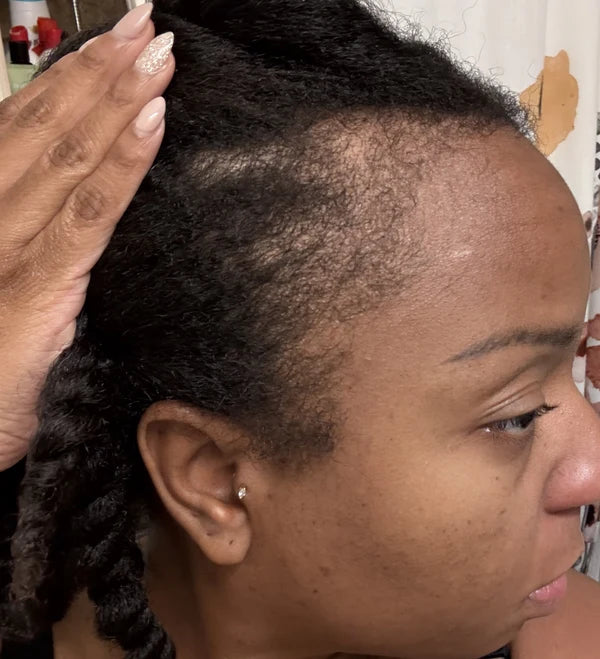 Illustrative model image for a sample Batana Natural Hair Oil review
