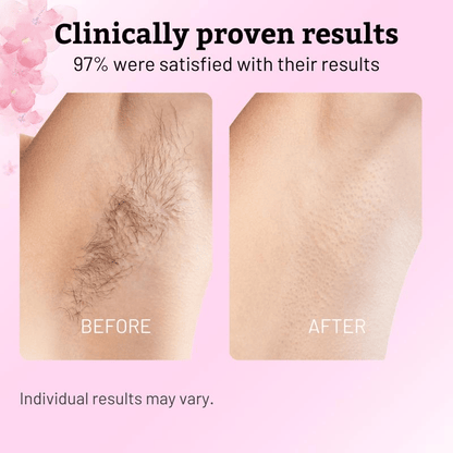 ✨ Caramela Beauty Cyperus Rotundus Oil for Natural Permanent Hair Reduction