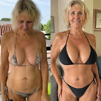 Targeted Breast Enhancement Advanced Nano Microneedle Patch